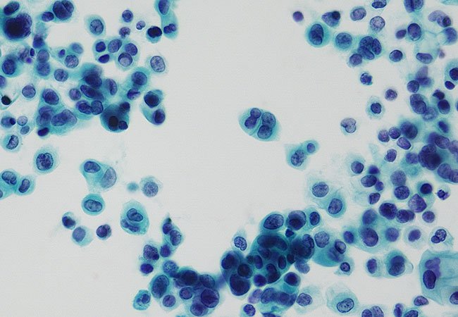 Wellgen 威捷生物醫學｜網頁設計、網站架設