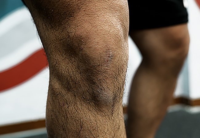 運動工場-傷害恢復健身中心｜網頁設計、網站架設